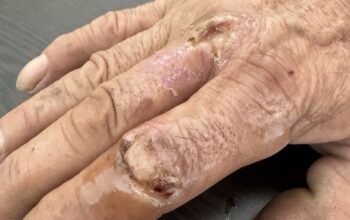 photo_5846235090642914351_y